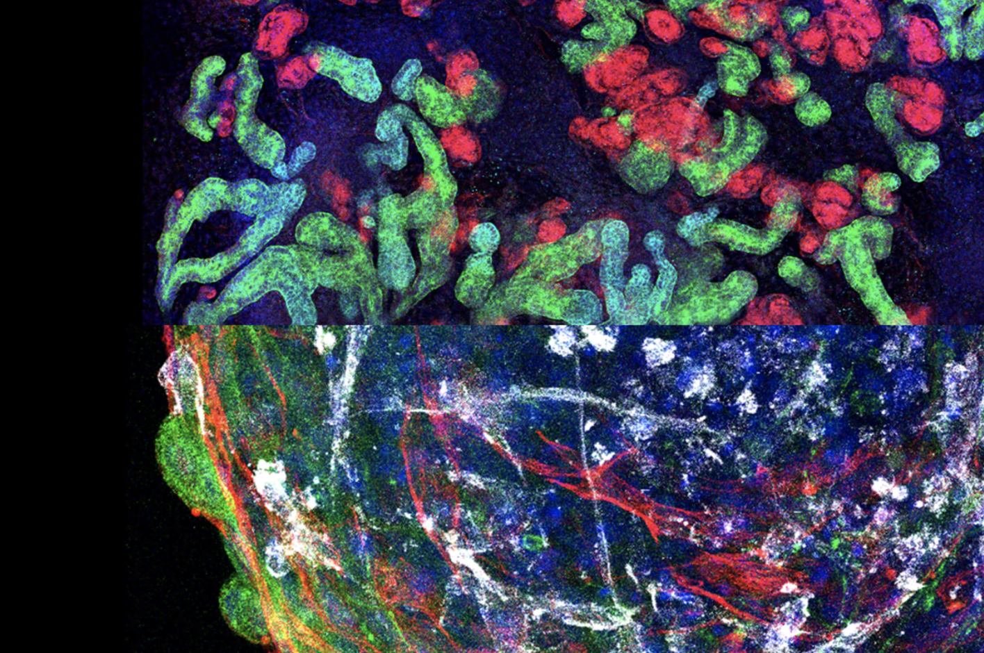 New multi-organ stem cell platform captures heart-kidney crosstalk