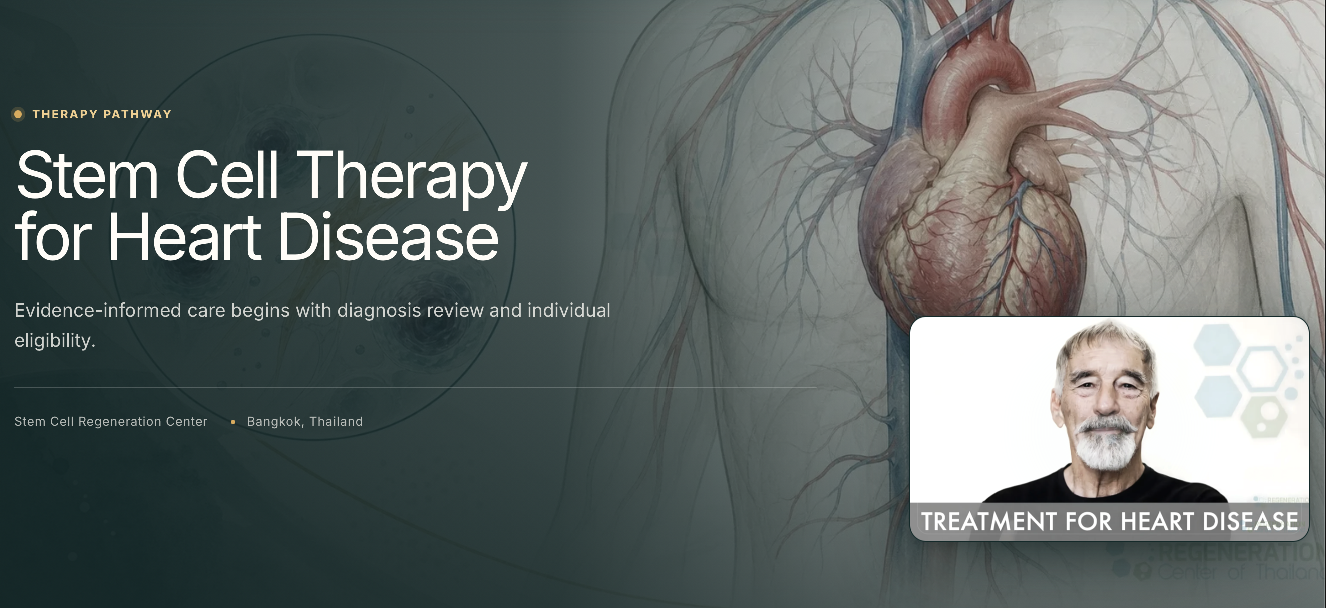 Stem Cell Therapy for Heart Disease